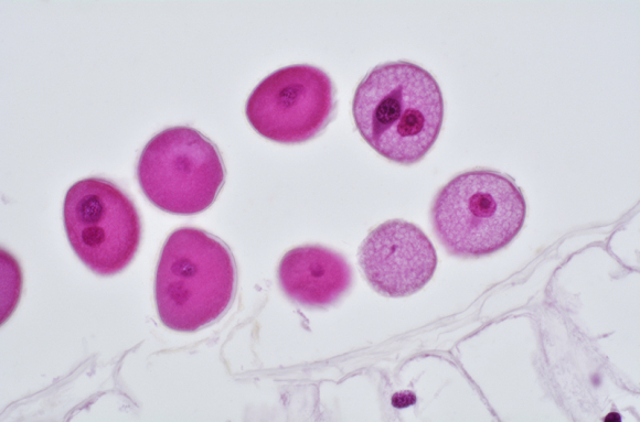 Cellules végétales en méiose