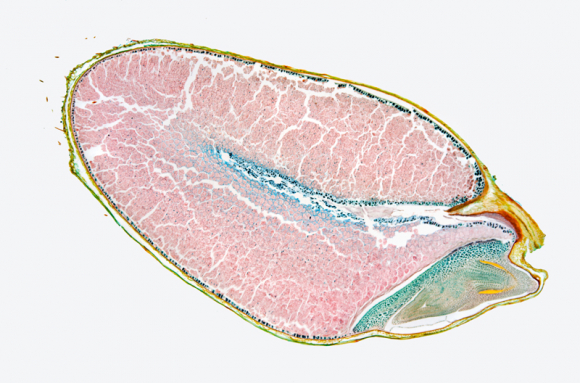 Histologie de l'appareil reproducteur