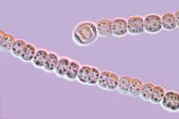 Cyanobactéries - Cyanophycées