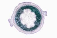 Structure secondaire des tiges