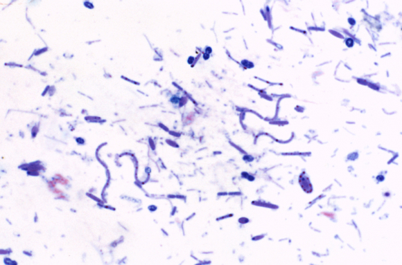 Bactéries et archées