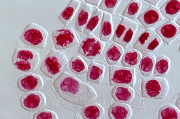 Cellules végétales en mitose