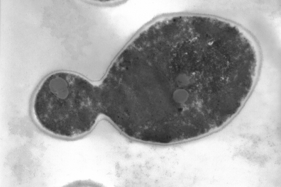 Levures et champignons au MET