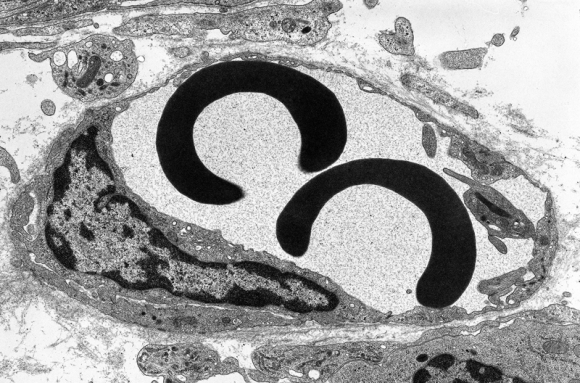 Ultrastructures (MET)